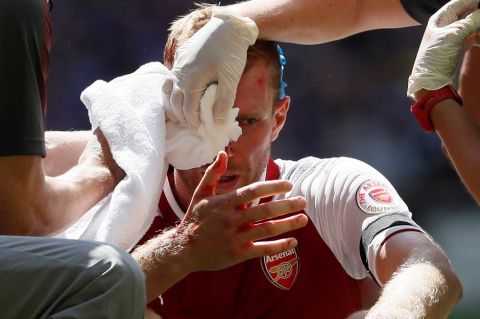 Arsenal's Per Mertesacker is treated by medical staff after getting injured during the English Community Shield soccer match between Arsenal and Chelsea at Wembley Stadium in London, Sunday, Aug. 6, 2017. (AP Photo/Kirsty Wigglesworth)