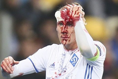 Dynamo Kiev's Domagoj Vida from Croatia leaves the field after being injured during the Group B Europa League soccer match between Dynamo Kiev and Young Boys at the Olympiyskiy stadium in Kiev, Ukraine, Thursday, Oct. 19, 2017. (AP Photo/Andriy Lukatsky)