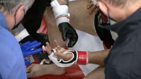 MMAer έχασε το δάχτυλό του κατά τη διάρκεια αγώνα και το έψαχνε με το κοινό
