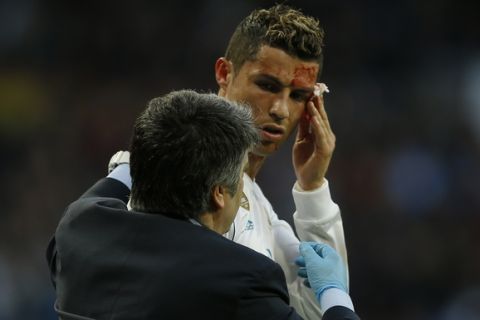 Real Madrid's Cristiano Ronaldo bleeds from his forehead during a Spanish La Liga soccer match between Real Madrid and Deportivo Coruna at the Santiago Bernabeu stadium in Madrid, Sunday, Jan. 21, 2018. (AP Photo/Francisco Seco)