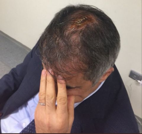 Πέντε ράμματα στο νοσοκομείο ο Γκιουνές, οριστική διακοπή στο Φενέρ - Μπεσίκτας (photos)