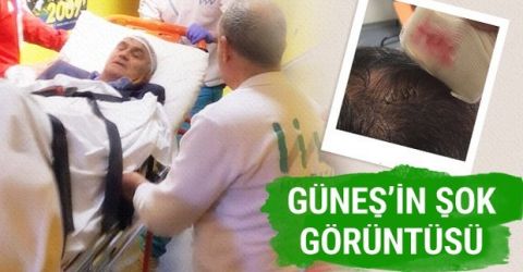 Φωτογραφίες και video του τραυματισμένου Γκιουνές στα αποδυτήρια
