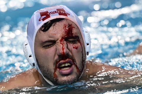 Ολυμπιακός - Μπαρτσελονέτα: Ο Μουρίκης τραυματίστηκε στο πρόσωπο σε σουτ αντιπάλου και βγήκε απ' την πισίνα με αίματα