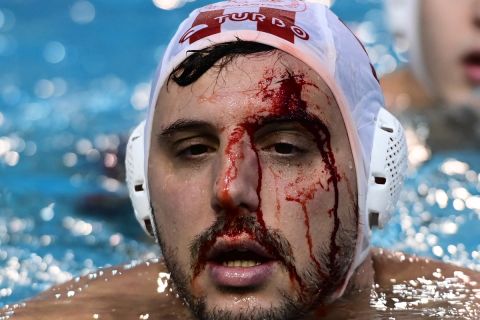 Ολυμπιακός - Μπαρτσελονέτα: Ο Μουρίκης τραυματίστηκε στο πρόσωπο σε σουτ αντιπάλου και βγήκε απ' την πισίνα με αίματα