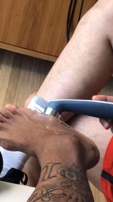 Το πόδι του Νεϊμάρ μετά το χειρουργείο