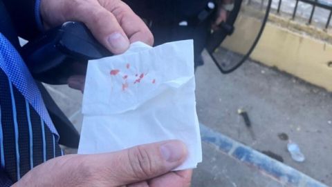 Πρόεδρος Καλαμάτας: "Μου άνοιξαν τ' αυτί με πέτρα και η Αστυνομία κοιτούσε"