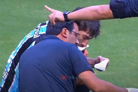Ο Λούκας Σίλβα τραυματίστηκε έπειτα από ρίψη κινητού στο πρόσωπό του 