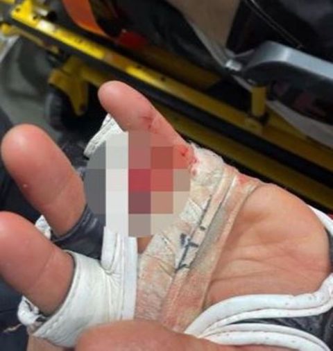 MMAer έχασε το δάχτυλό του κατά τη διάρκεια αγώνα και το έψαχνε με το κοινό