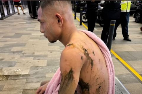 Στην εντατική διεθνής ποδοσφαιριστής της Μαλαισίας μετά από επίθεση με καυστικό υγρό