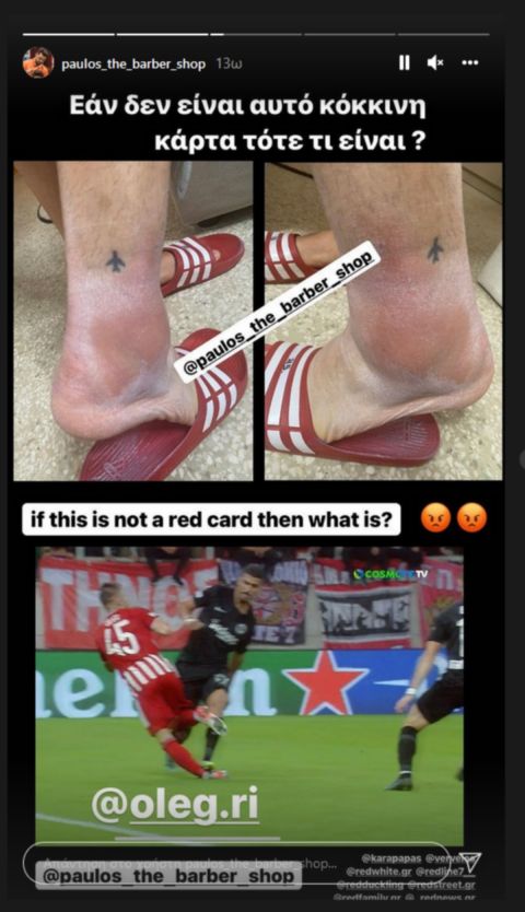 Ο κομμωτής του Ρέαμπτσουκ φωτογράφισε το πρησμένο πόδι του από το ματς με την Άιντραχτ