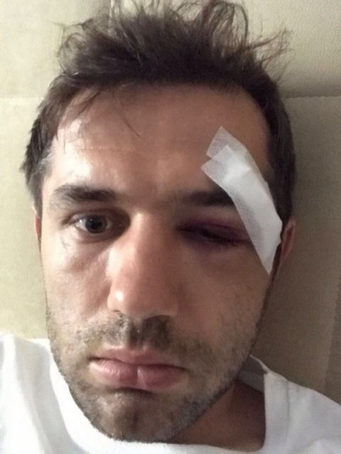 Ο τραυματισμός του Λούλιτς από το χτύπημα του Τοροσίδη