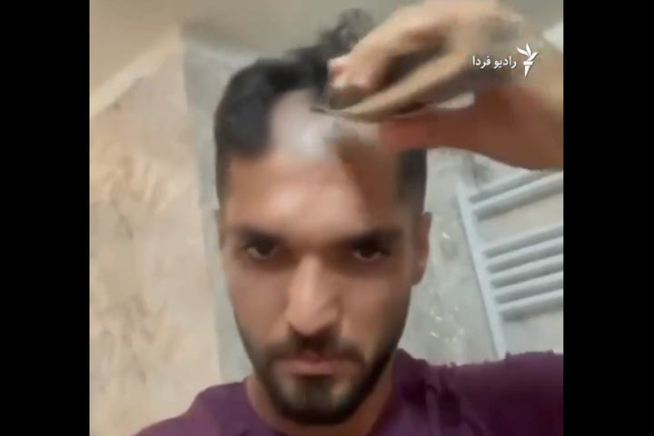 Ιρανός ποδοσφαιριστής ξύρισε το κεφάλι του για να στηρίξει τον αγώνα των γυναικών στη χώρα του