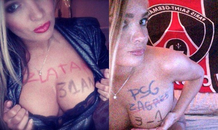 Παρί… δαγκωτό η Γαλλίδα πορνοστάρ!