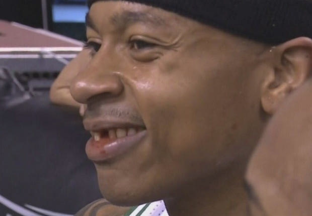 Μείον ένα δόντι για τον Isaiah Thomas!