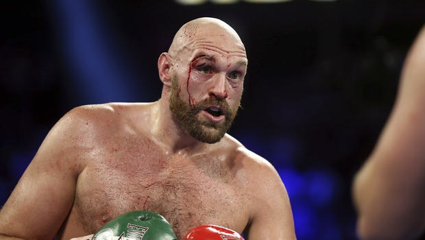 Fury: “Αυτή την φορά δεν πάω για την νίκη, αλλά για την διάλυση του Wilder”