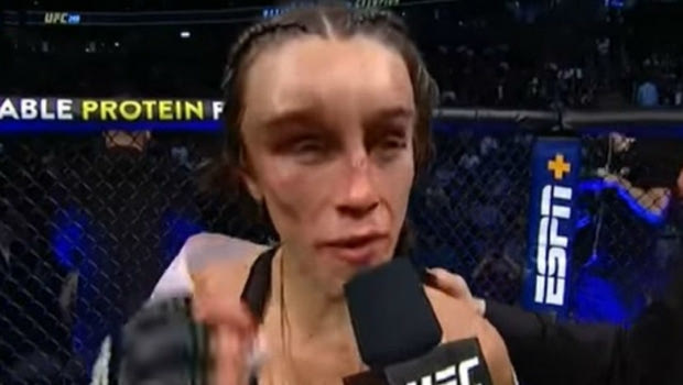 Joanna Jedrzejcyzk: Ανατριχιαστική η παραμόρφωση μετά το UFC 248