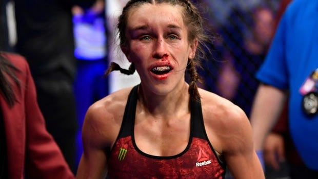 Jedrzejczyk: “Δεν έβλεπα από το αριστερό μου μάτι”