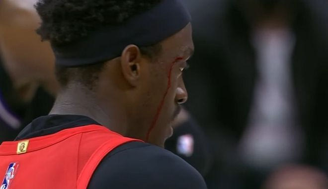Μάτωσε ο Σιάκαμ και στο γήπεδο ακούστηκε το “Keep bleeding in love”