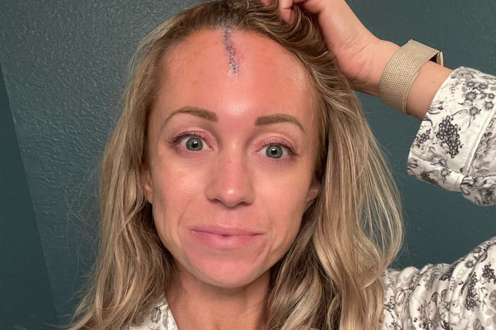 Ρεπόρτερ χτυπήθηκε στο κεφάλι από μπάλα του μπέιζμπολ με 152 χλμ/ώρα