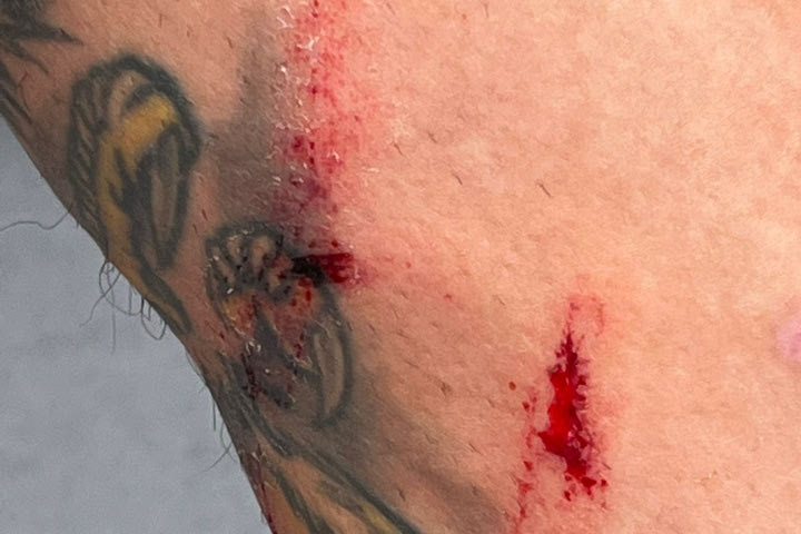 Παράπονα με φωτογραφία από την Ατλέτικο για τη διαιτησία στο ντέρμπι με τη Ρεάλ: “Αυτό είναι το πόδι του επιθετικού μας”