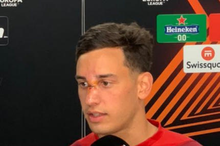 Ολυμπιακός: Η φωτογραφία που δείχνει τη μεγάλη ζημιά του Έσε στη μύτη μετά από το σκληρό μαρκάρισμα που δέχθηκε