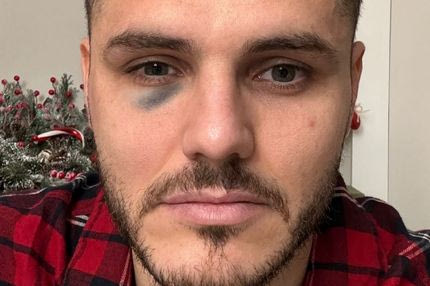 Süper Lig: Πόλεμος με δηλώσεις και VIDEO των Γαλατάσαραϊ και Ικάρντι με Φενέρμπαχτσε και Τζέκο για το μαυρισμένο μάτι του Αργεντινού