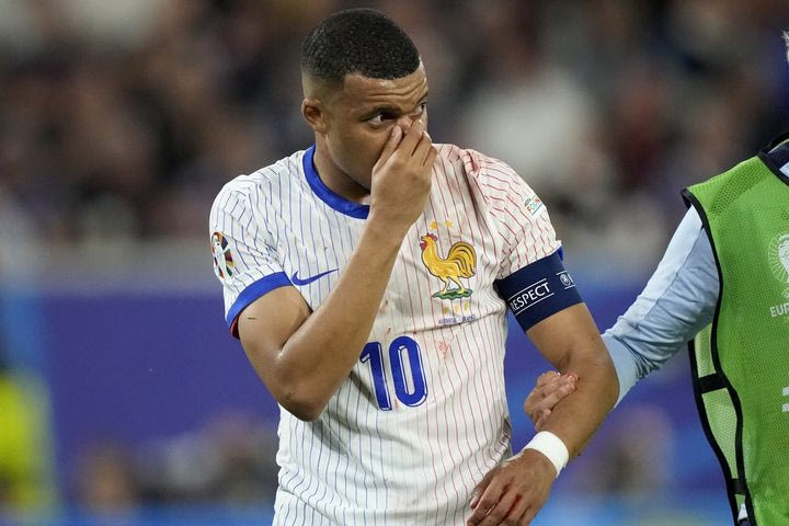 Euro 2024, Αυστρία – Γαλλία: Άνοιξε η μύτη του Εμπαπέ μετά από σύγκρουσή του με τον Ντάνσο