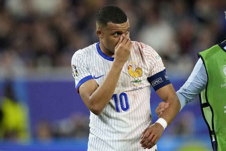 Euro 2024, Εθνική Γαλλίας: Ο Εμπαπέ χάνει τον αγώνα με την Ολλανδία