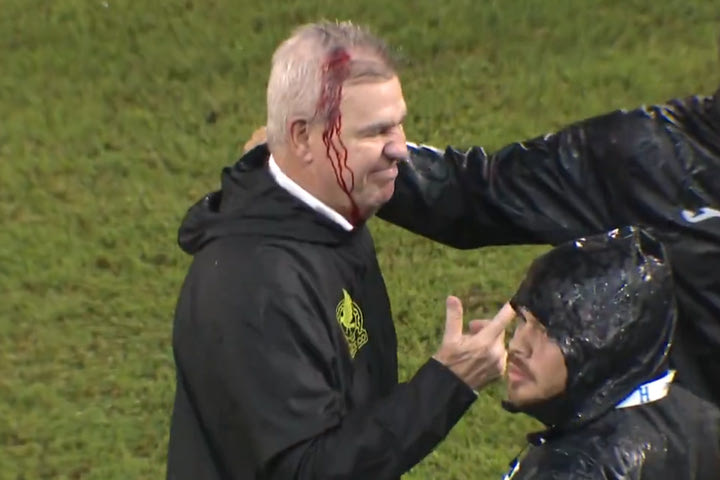 Ο Χαβιέρ Αγκίρε αποχώρησε αιμόφυρτος στο Ονδούρα – Μεξικό, βασικός ο Πινέδα, δύο γκολ ο Λουίς Πάλμα