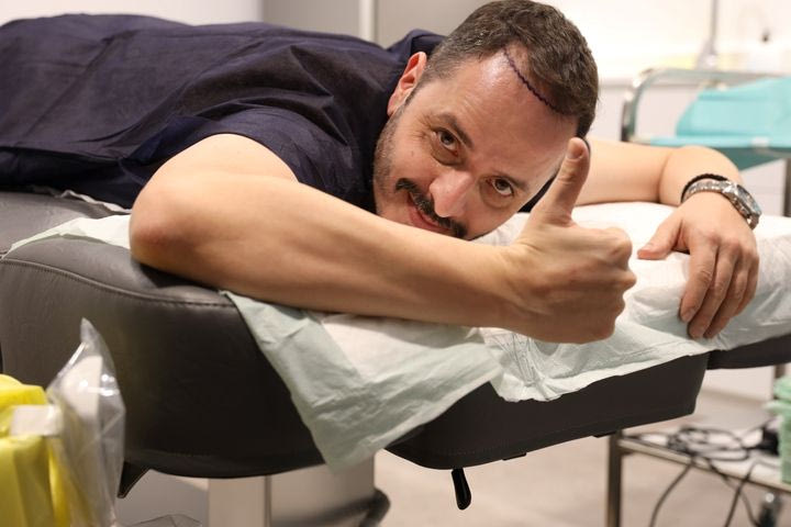 Η κλινική που εμπιστεύονται οι διάσημοι για την μεταμόσχευση μαλλιών