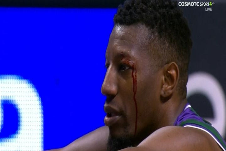 Μάλαγα – Ρεάλ: Σε “ρινγκ” μετατράπηκε το “Μαρτίν Καρπένα” στα τελευταία 2’50”, μάτωσαν δύο παίκτες των Ανδαλουσιανών