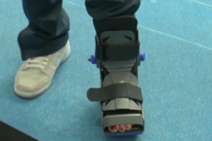 Εθνική πόλο γυναικών: Με ειδική μπότα στο αριστερό της πόδι εμφανίστηκε η Σιούτη στις δηλώσεις μετά την κατάκτηση του χρυσού