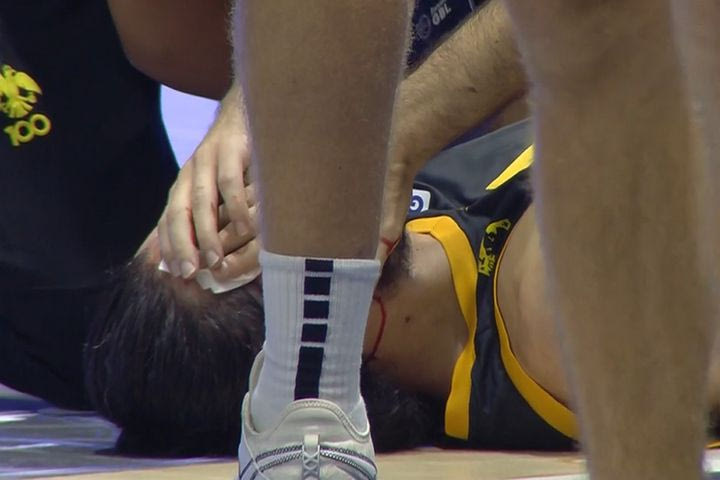 Κολοσσός – ΑΕΚ: Μάτωσε στο φρύδι ο Κατσίβελης