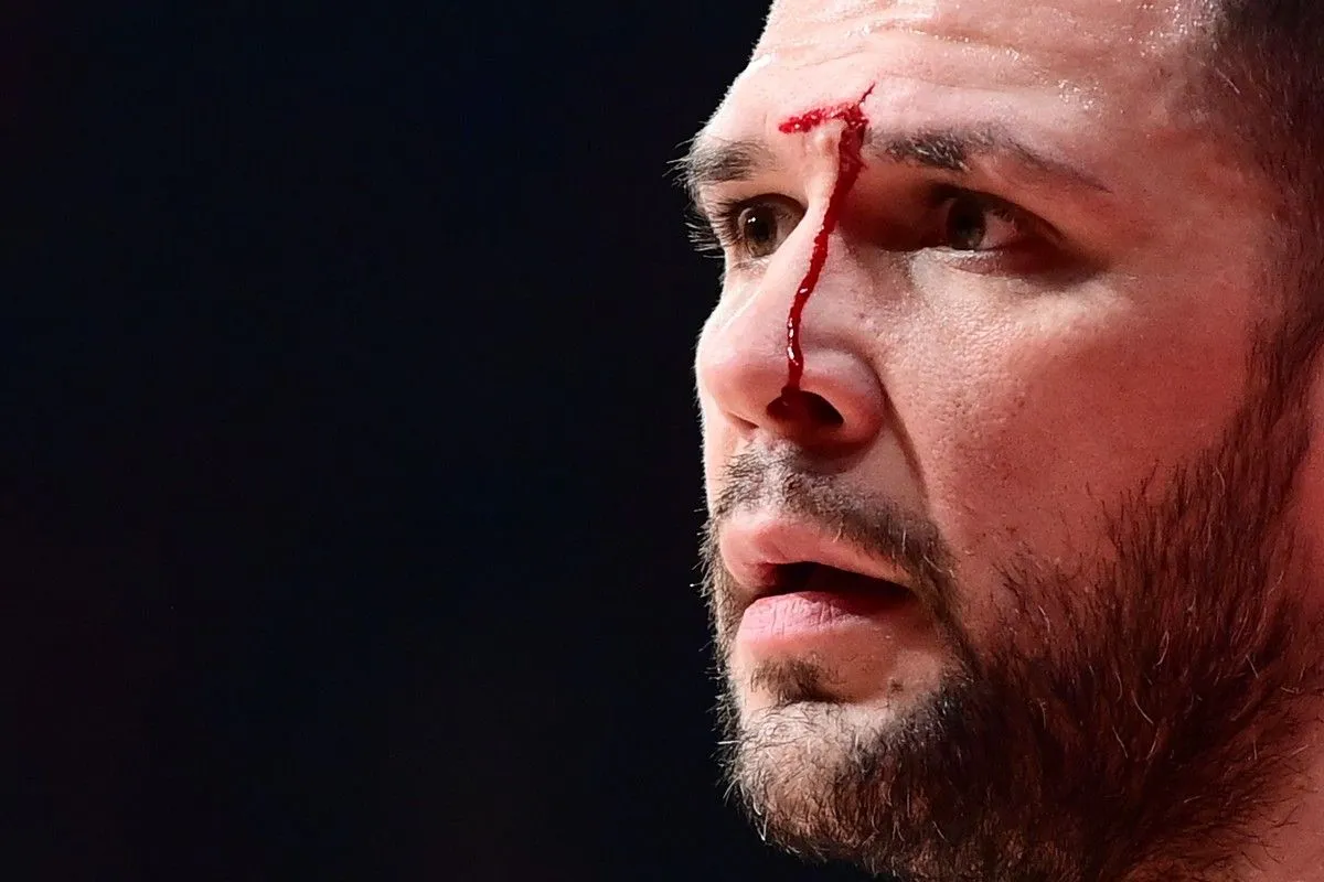 Ολυμπιακός – Βιλερμπάν: Μάτωσε στο πρόσωπο ο Παπανικολάου από αγκωνιά του Βοτιέ