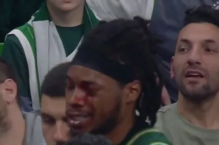 Ο Χολμς μάτωσε στο μάτι από χτύπημα του Μπιτίμ