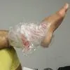 Ολυμπιακός: Με πάγο στον αστράγαλο ο Τζολάκης, λόγω χτυπήματος στη φάση που απέκρουσε το σουτ του Γερεμέγεφ