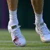 Wimbledon: Ο Σίνερ μάτωσε κυριολεκτικά για να λυγίσει τον Κετσμάνοβιτς